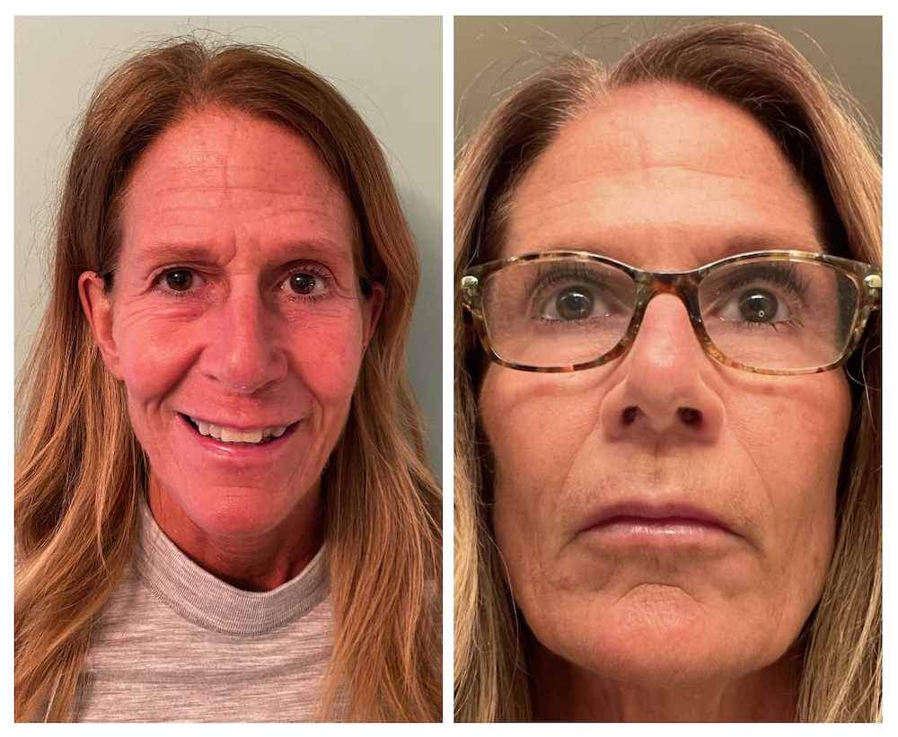 Bloom Bank – Bloom MedAesthetics – Bloom Bank