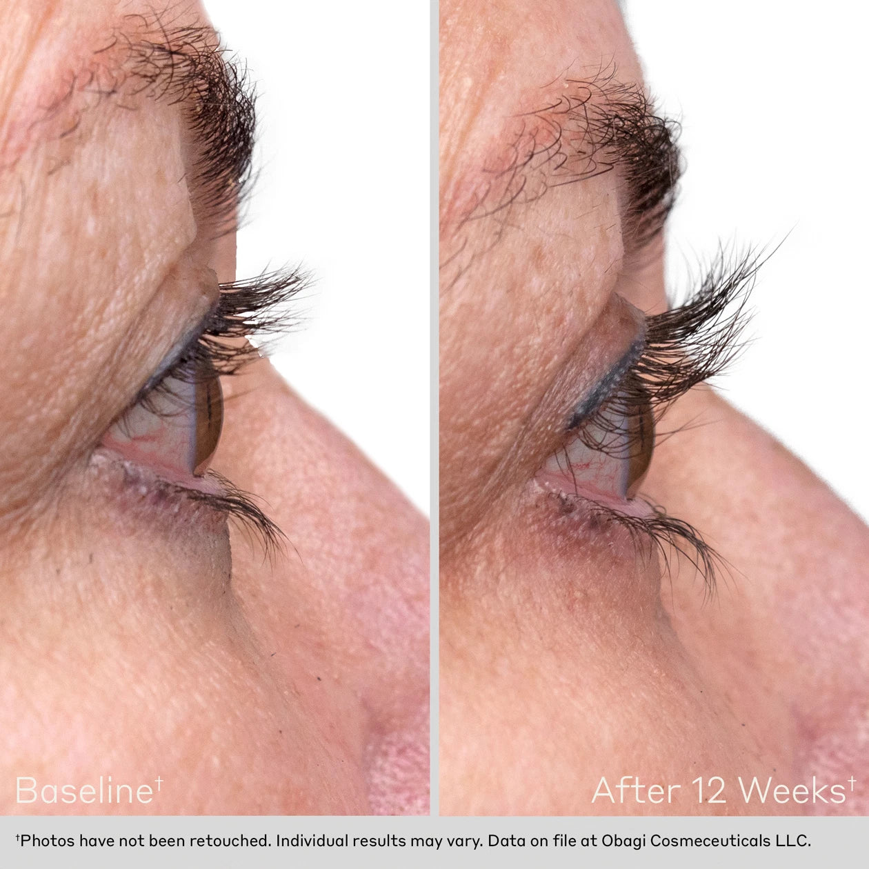 EYELASH ENHANCING SERUM – Bloom MedAesthetics EYELASH ENHANCING SERUM - Image 4